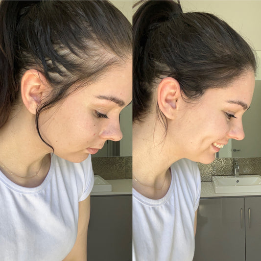 Hair Fibers Before and After